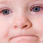 Pinkeye (conjonctivite) chez les bébés