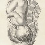 Qu’est-ce qu’un bébé au côté ensoleillé ?