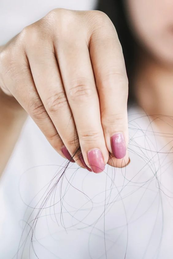 La contraception peut-elle provoquer la chute des cheveux ?