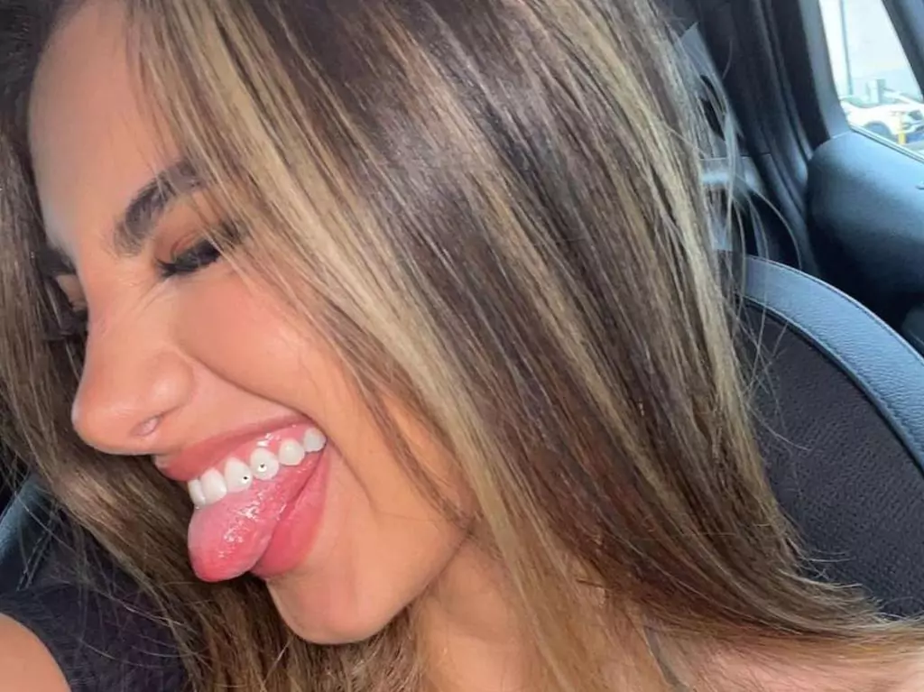 Do Tooth Gems Ruin Your Teeth