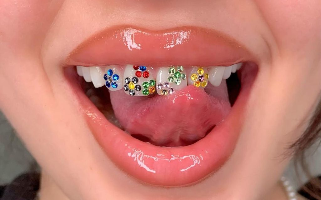 Teeth Gems
