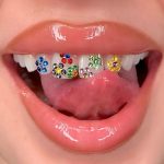 Teeth Gems